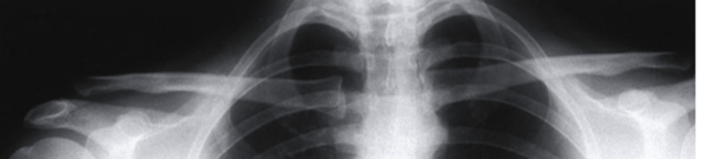 <p>Based on this photo, is this person WB or NWB?</p>