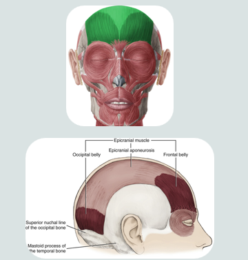 <ul><li><p>a muscle of facial expression</p></li><li><p>used when making a “surprised face”</p></li><li><p>this muscle covers part of the skull</p></li><li><p>consists of two bellys that are separated by a large spread out scalpal tendon</p><ul><li><p>occipital</p></li><li><p>fontal</p></li></ul></li></ul><p></p>