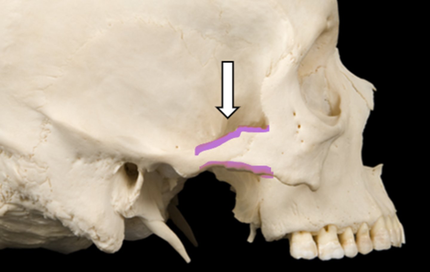 <p>name the part</p>