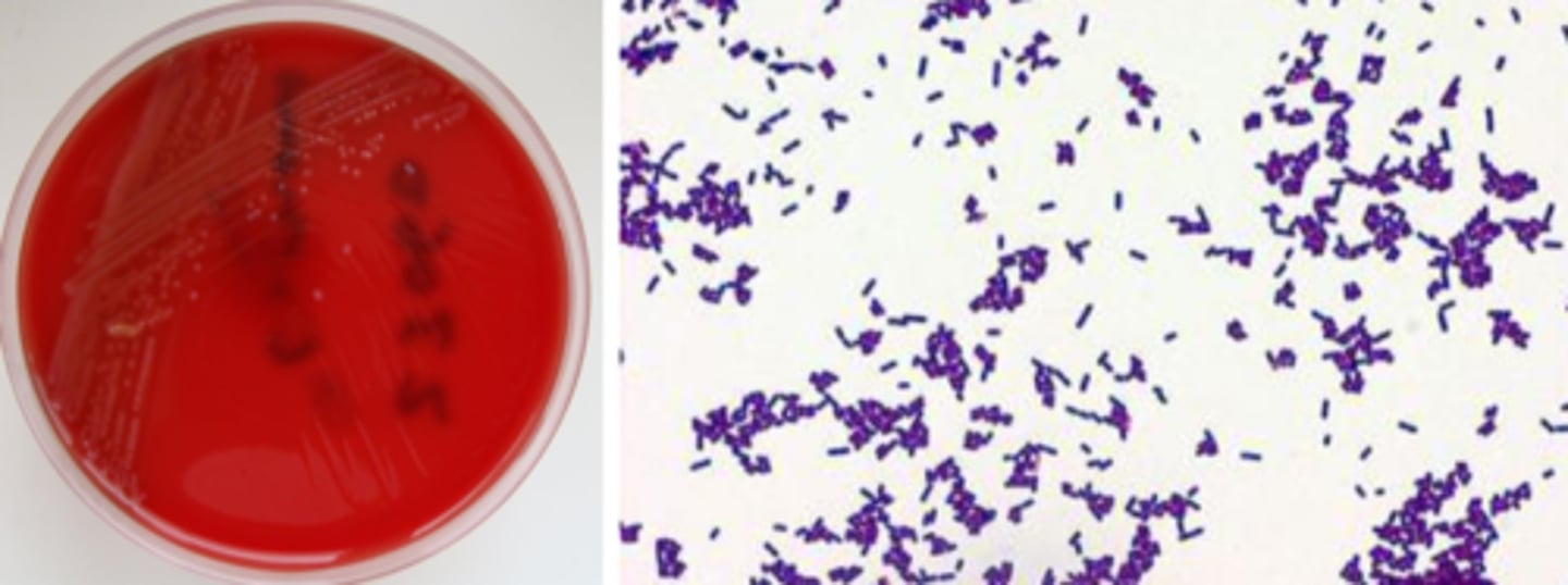 <p>beta hemolytic (small zone)</p><p>grey pigment</p><p>smallish colony, bacilli in stacks</p>