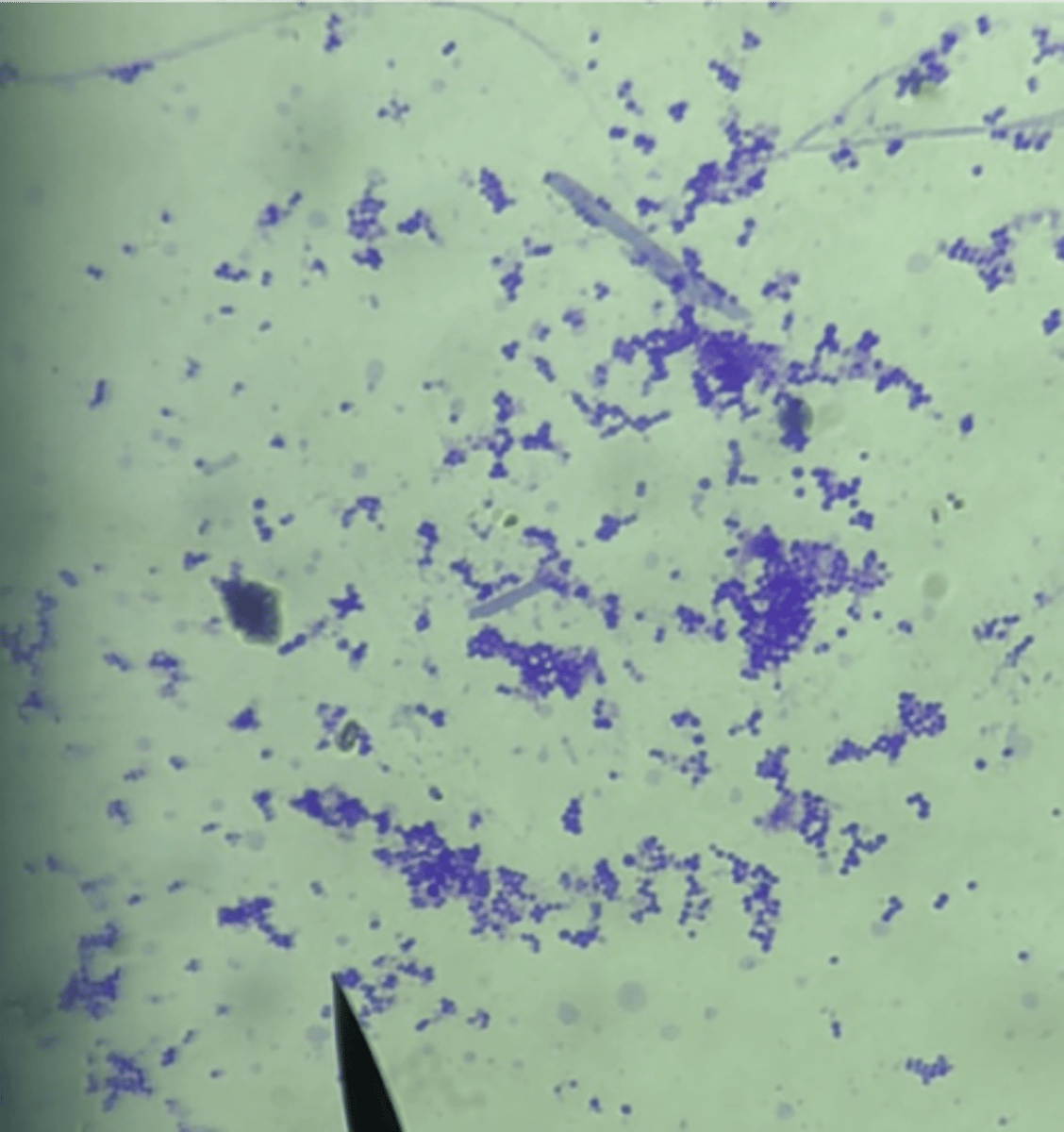 <p>What bacteria is this stained with methylene blue?</p>