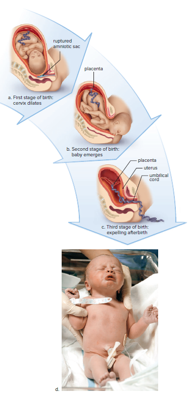 Three stages of birth (parturition).