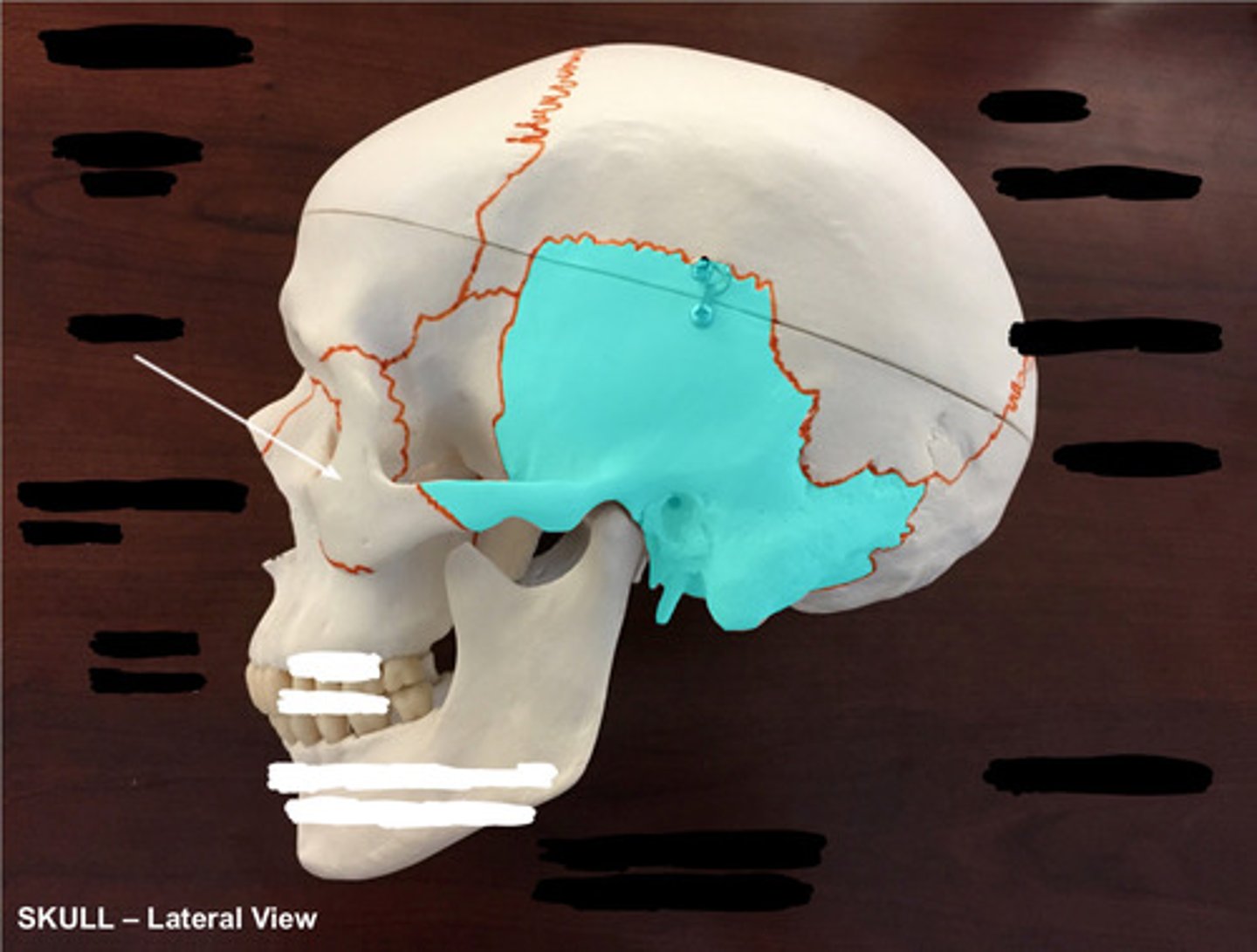 <p>What bone is highlighted here?</p>