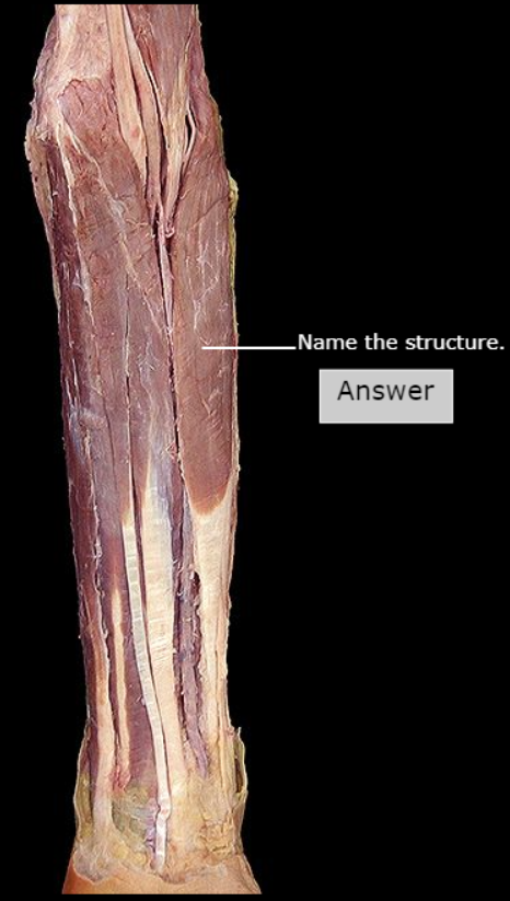 <p>What structure is this?</p>