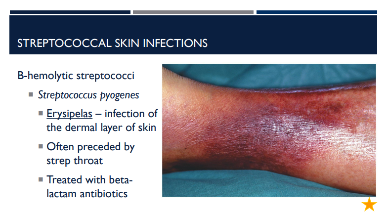 <p>Erysipelas is an infection of the dermal layer of the skin. What bacteria is it caused by?</p>