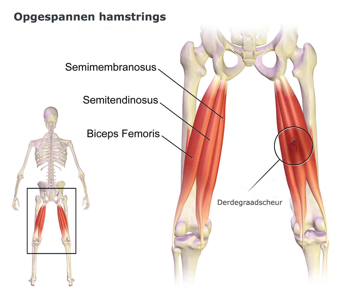 <p>Hamstring Group</p>
