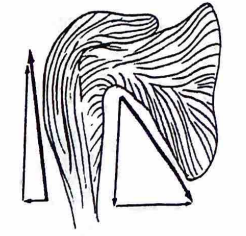 <p>In the example shown at right the deltoid and oblique rotator cuff muscles function as a force couple to abduct the should joint. What is the importance of the offsetting vertical force components?</p><p>a. They push the humeral head against the acromion.</p><p>b. They prevent excessive anterior/posterior translation of the humeral head.</p><p>c. They stabilize the humeral head on the glenoid.</p><p>d. They limit the amount of internal rotation that accompanies abduction.</p>