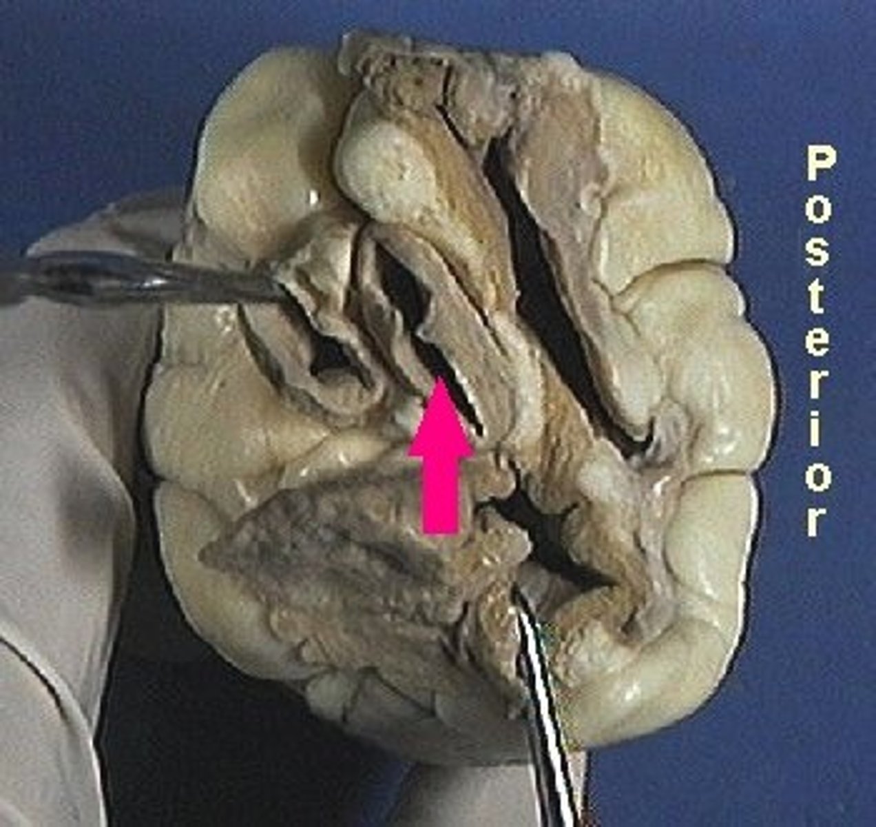 <p>Identify the blood vessel.</p>