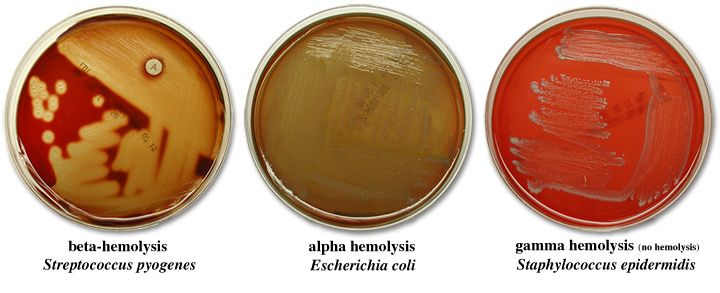 <ul><li><p>no zone of hemolysis</p></li><li><p>No lysis</p></li></ul><p></p>