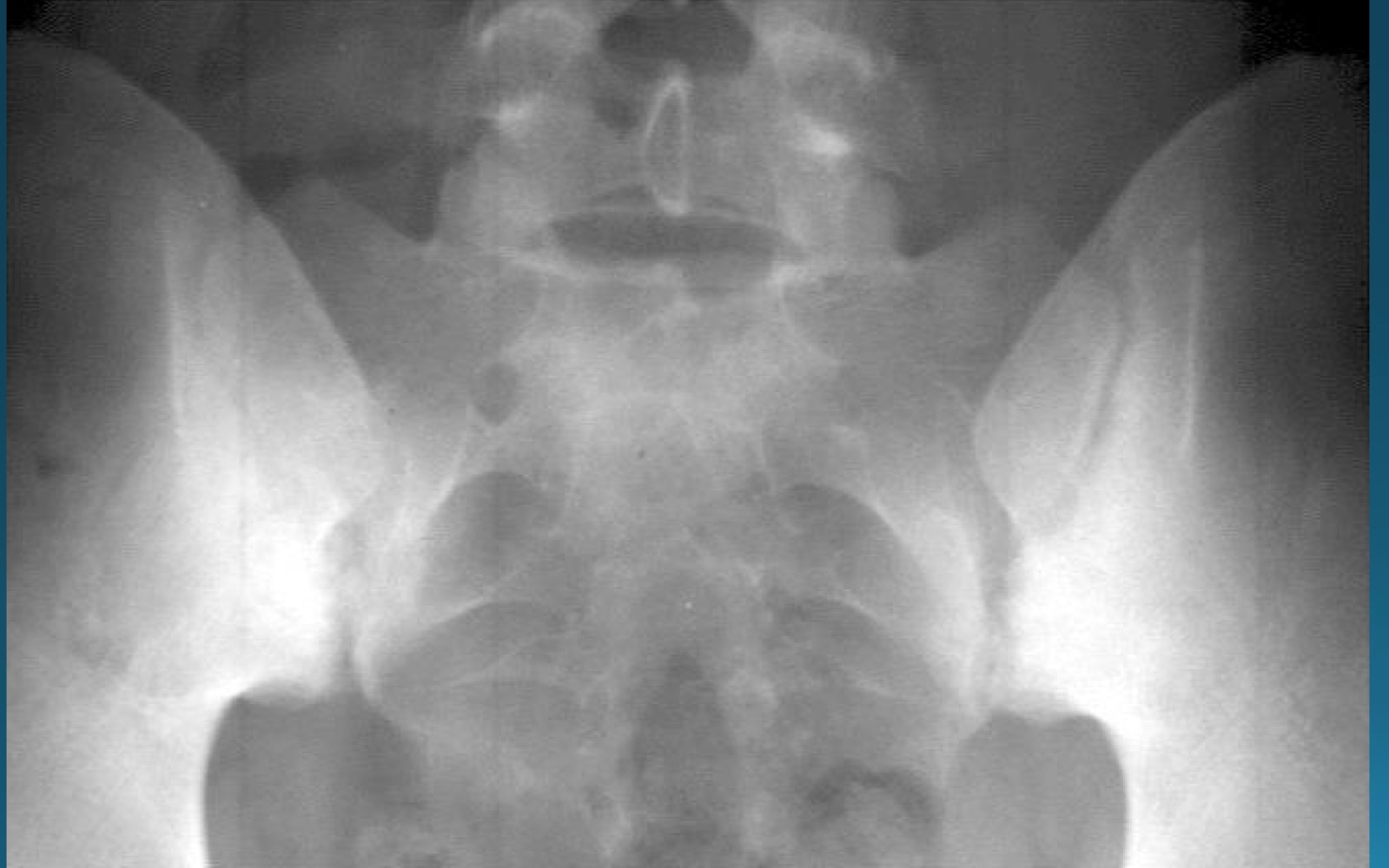 <p>what are the signs seen in this image? what diagnosis would you make </p>