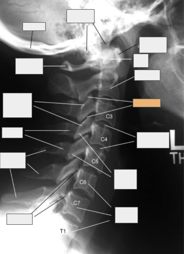 <p>What structure of the spine does the box highlighted in orange reference to?</p>