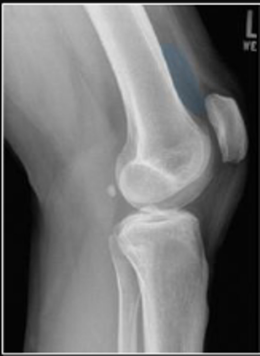 <p>What is outlined?</p>