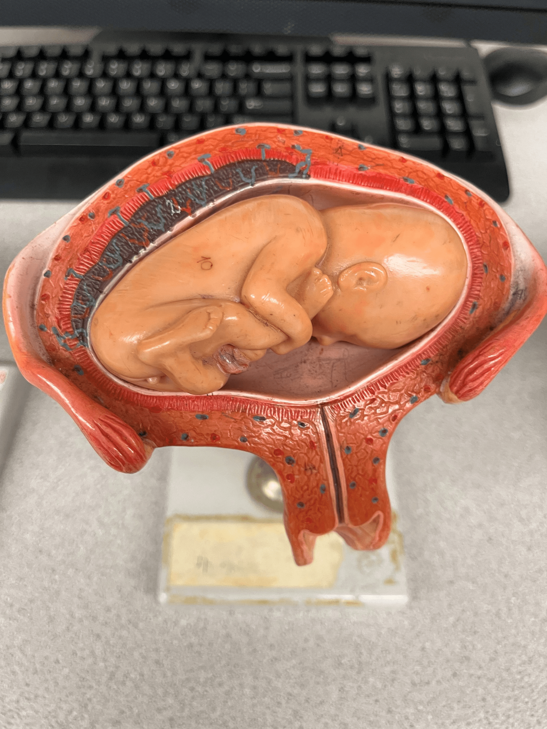 • Model of the developing fetus in the uterus.

• The position in which the fetus faces downwards.
