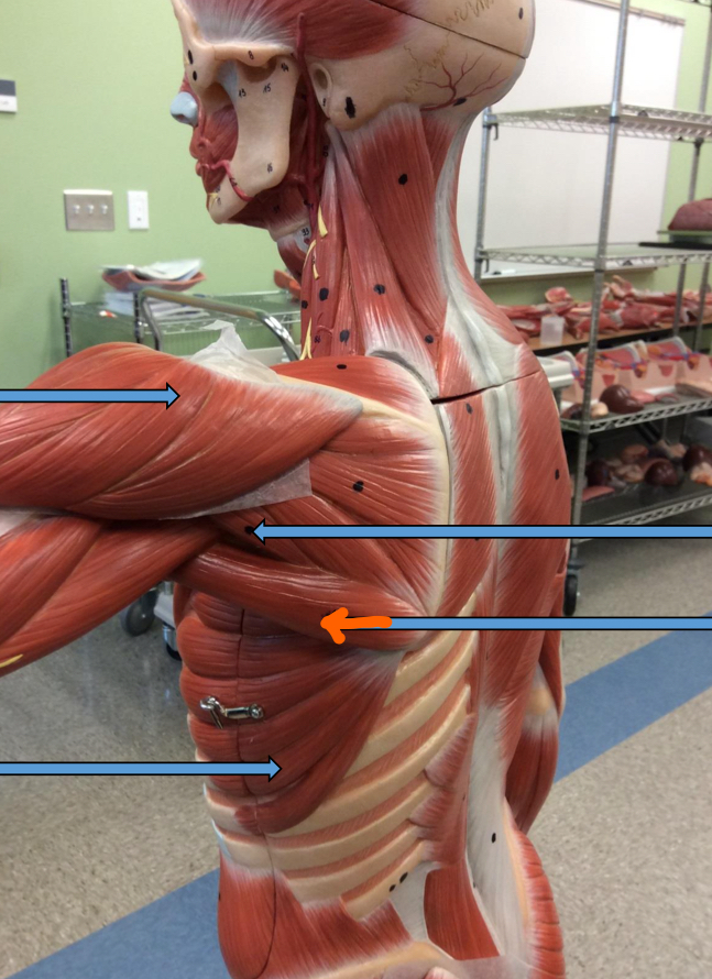 <p>Identify this muscle?</p>