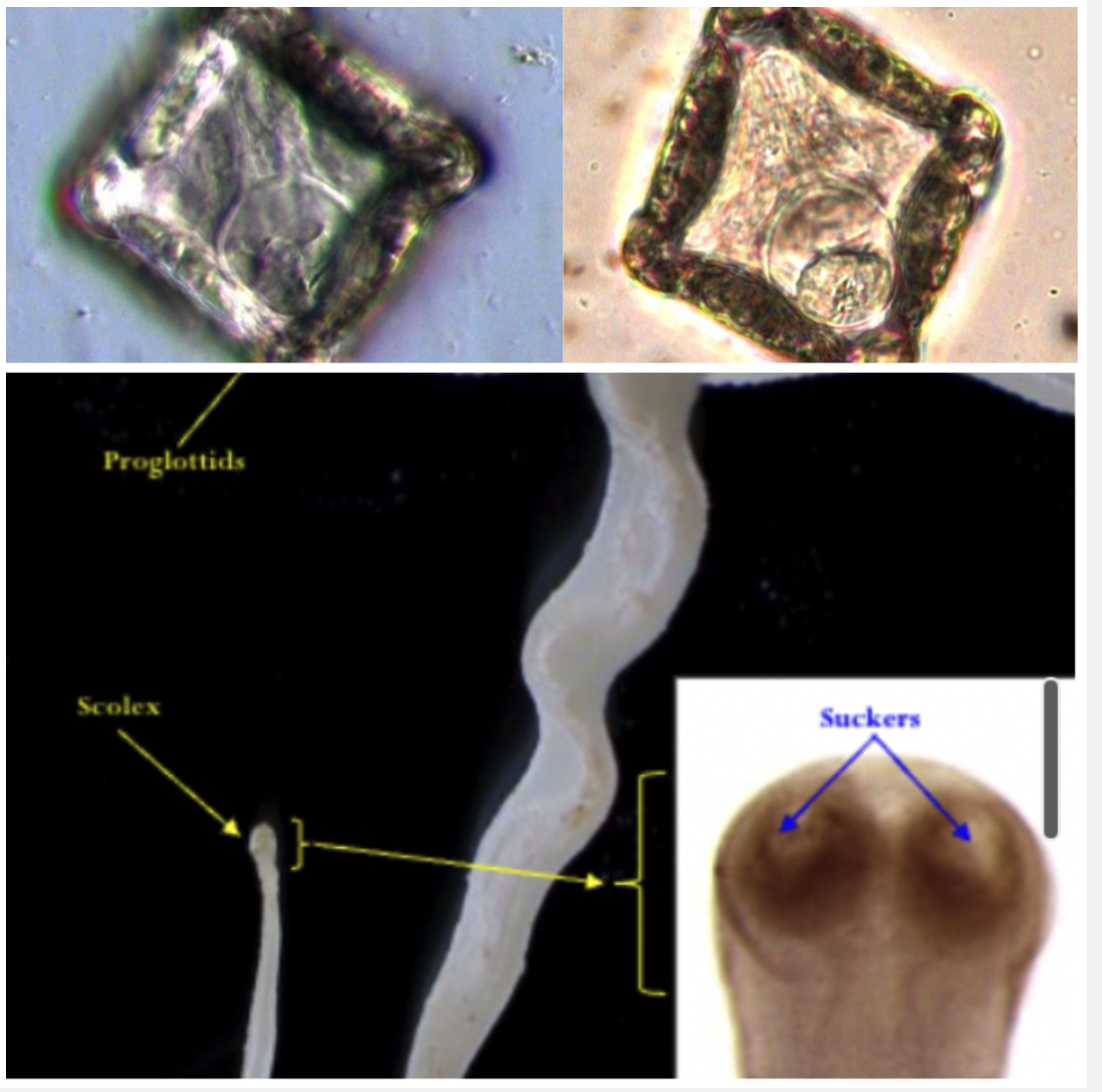 <p>SMALL INTESTINE Your lambs have diarrhoea , anaemia and weight loss after 6-8 weeks of being on a pasture used by adult sheep.</p><ul><li><p>Ingestion of cysticercoid larvae in orbatid mites (IH)</p></li><li><p>2 sets of reproductive organs, 2 genital pores Square eggs with pyriform apparatus</p></li></ul>