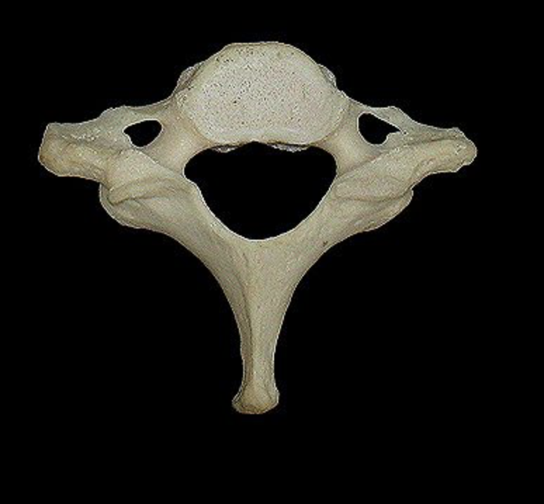 <p>What structure is this?</p>