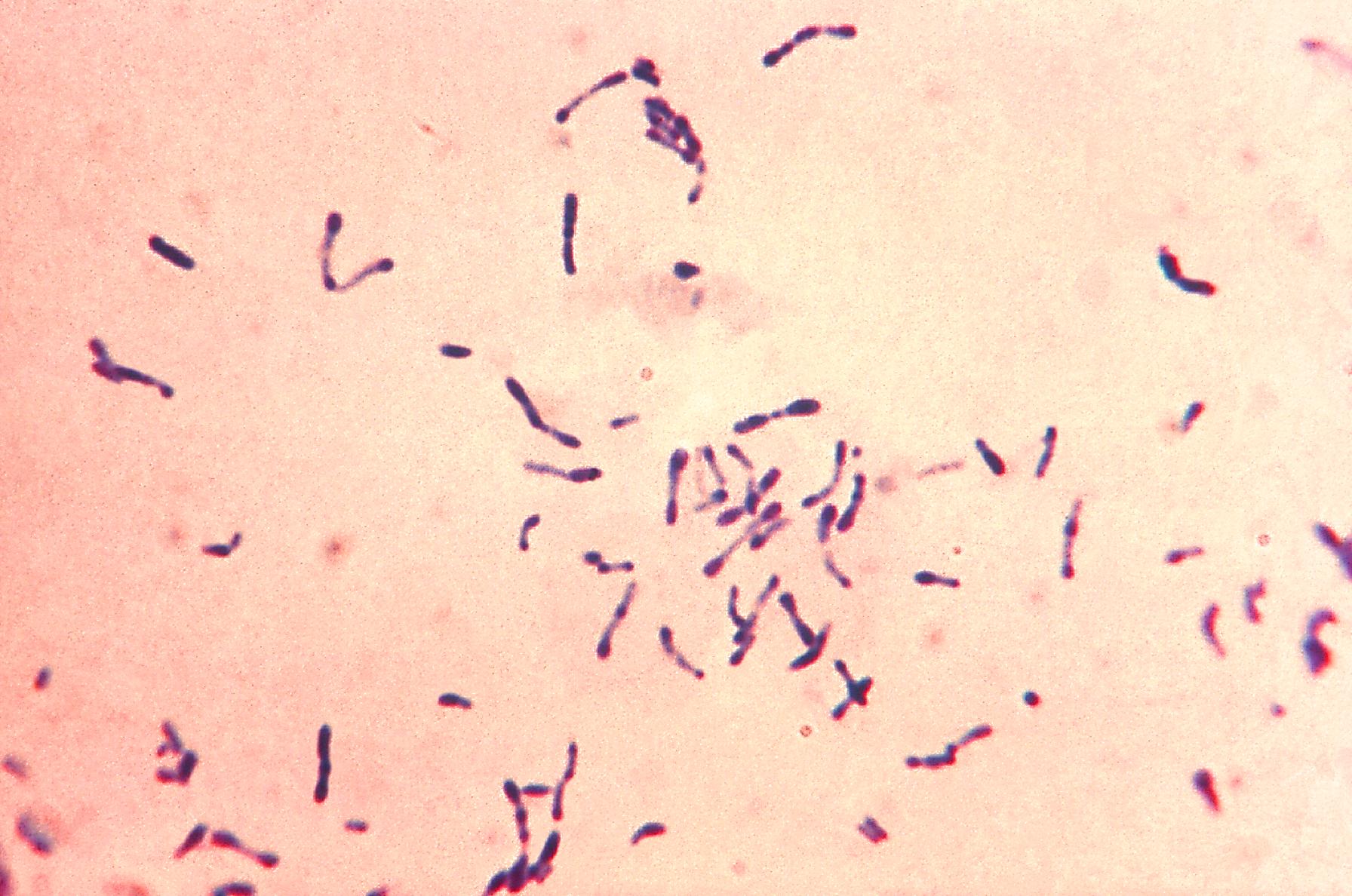 <p>With <strong>metachromatic (blue and red) granules </strong>when stained with methylene blue</p>