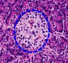 Is the gland endocrine or exocrine?