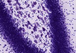 nissl stain