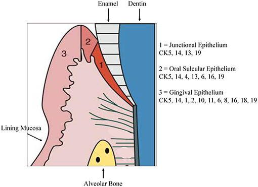 <ul><li><p>Lines the <strong>lateral wall of the gingival sulcus</strong></p></li><li><p>Continuous with occlusal end of junctional epithelium <strong>apically</strong>; with oral gingival epithelium <strong>occlusally</strong></p></li><li><p>Histologically — dark cells due to <strong>basophilic staining</strong></p></li><li><p><strong>Stratified</strong>; frequently <strong>parakeratinized</strong>; no homogenous stratum corneum</p></li><li><p><strong>Less permeable</strong> than junctional epithelium, not infiltrated with migrating leukocytes</p></li></ul><p></p>