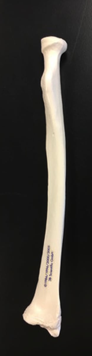 <p>right or left?</p>