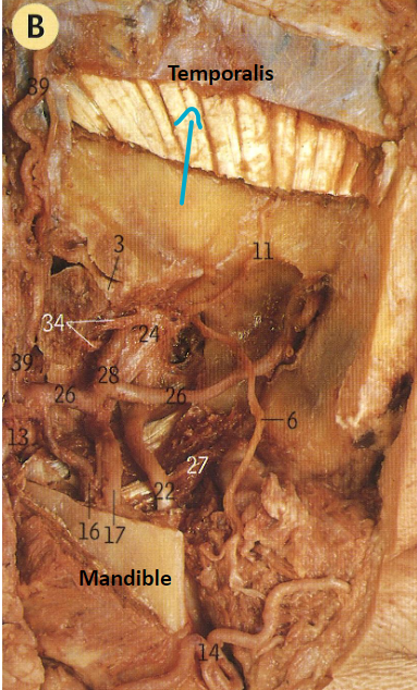 <p>what muscle?</p>
