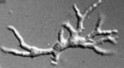 <p><strong>Identify the parasitic stage.</strong></p><p><strong>Mention two morphological characteristics of this stage.</strong></p><p><strong>Mention the possible human samples used for diagnosis, and the culture medium used</strong></p>