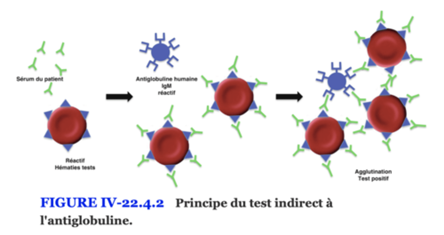 <p>Test indirect à l’antiglobuline (TIA, ou Coombs indirect)</p><p>Objectif : rechercher des anticorps libres circulants dans le plasma du patient.</p><p>Méthode :</p><p>On mélange le sérum du patient avec des GR tests connus.</p><p>Si le sérum contient des anticorps → ils se fixent sur les GR.</p><p>On ajoute ensuite l’antiglobuline → agglutination si fixation d’Ig.</p><p>Utilité : moins spécifique pour le diagnostic d’AHAI, plus utilisé en transfusion (compatibilité sanguine).</p>