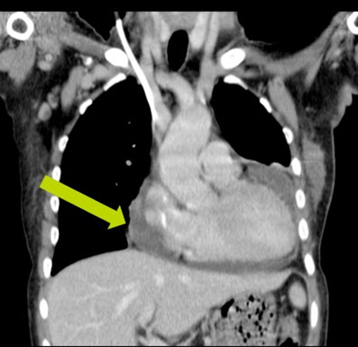 <p>Label pathology in image below</p>