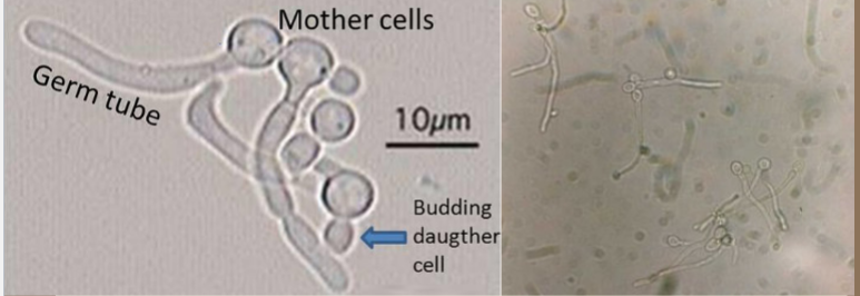 <p>Candida albicans germ tube</p>