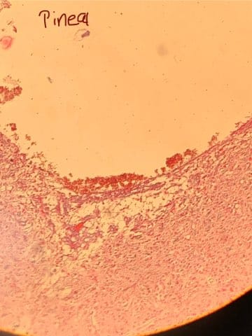 <p>Identify this slide.</p>