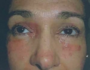 <ul><li><p>Identify the disease</p></li><li><p>Clinical feature</p></li></ul><p></p>