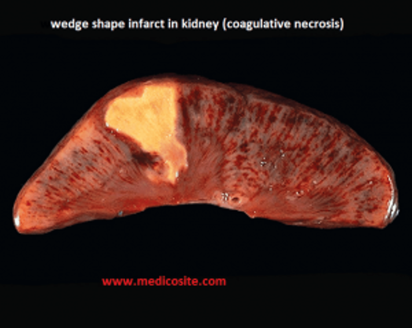 <p>architecture of dead tissues that displays a firm texture</p>