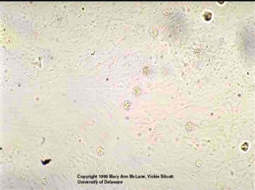 <p>cocci, bacilli, rods, ect.</p>