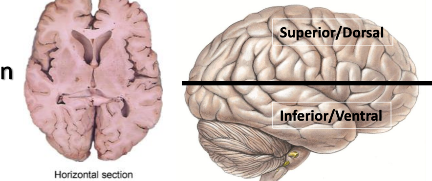 <p>cuts brain into superior/dorsal and inferior/ventral sections</p>