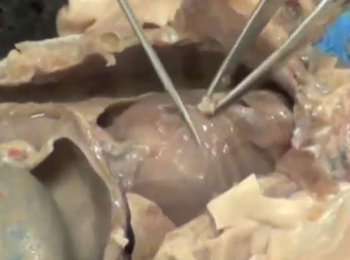 <p>What is this membrane covering the heart?</p>