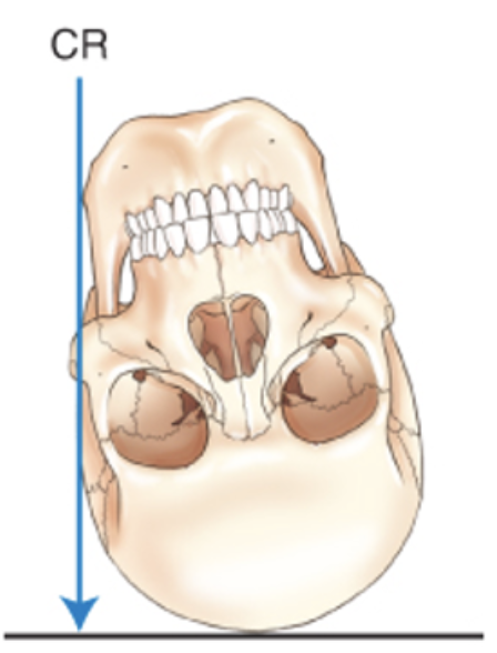 <p>Describe this special projection.</p>