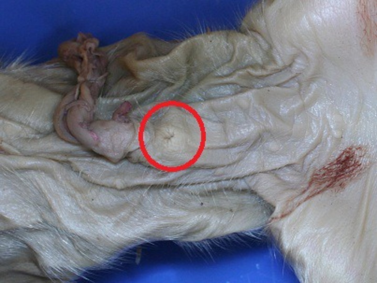 <p>What system does the Penis belong to?</p>