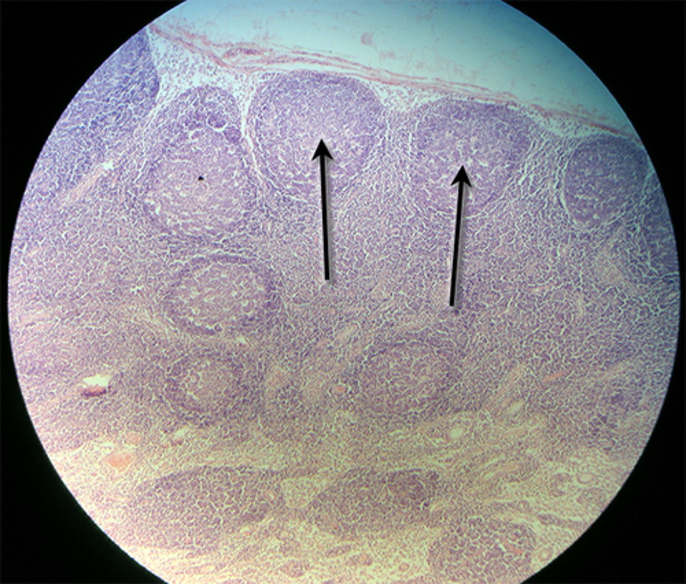 <p>area found within the lymph node that produces the lymphocytes Center!</p>