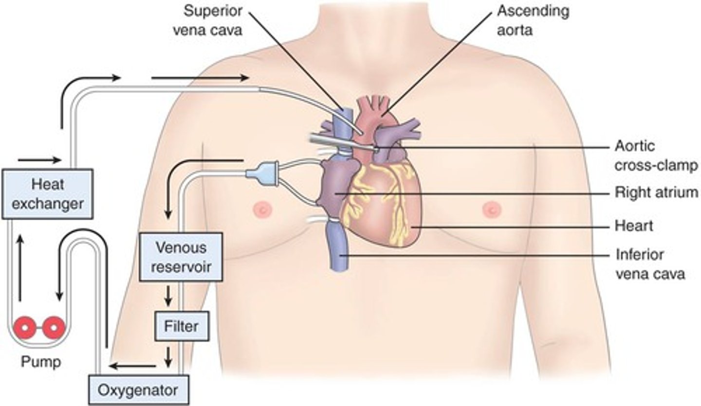 <p>method used to divert blood away from the heart and lungs temporarily when surgery of the heart and major vessels is performed, a heart-lung machine collects the blood, replenishes it with oxygen, and returns it to the body</p>