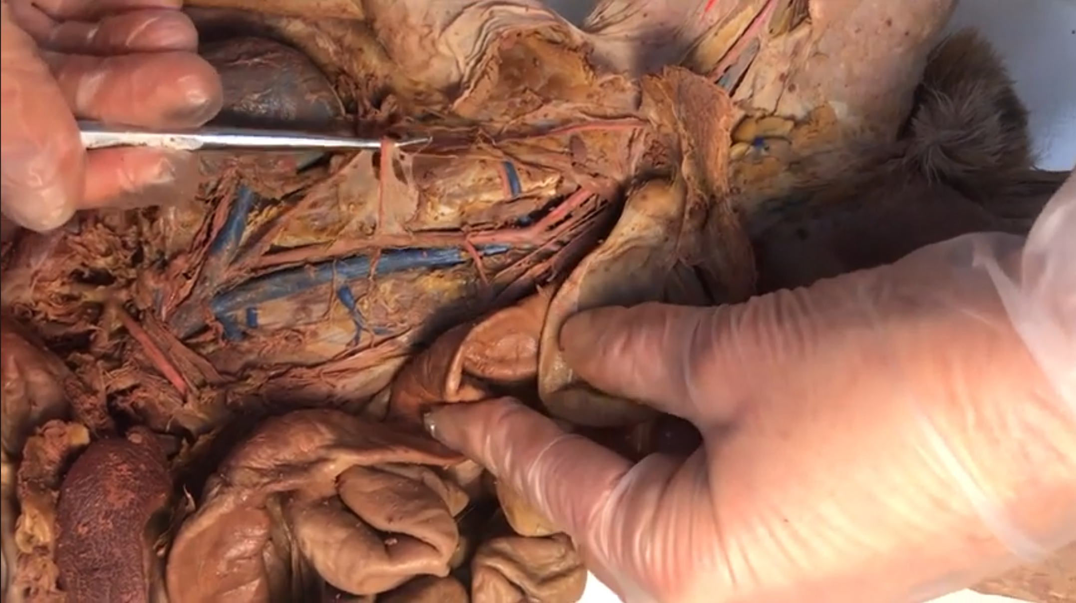 <p>What artery is this</p>