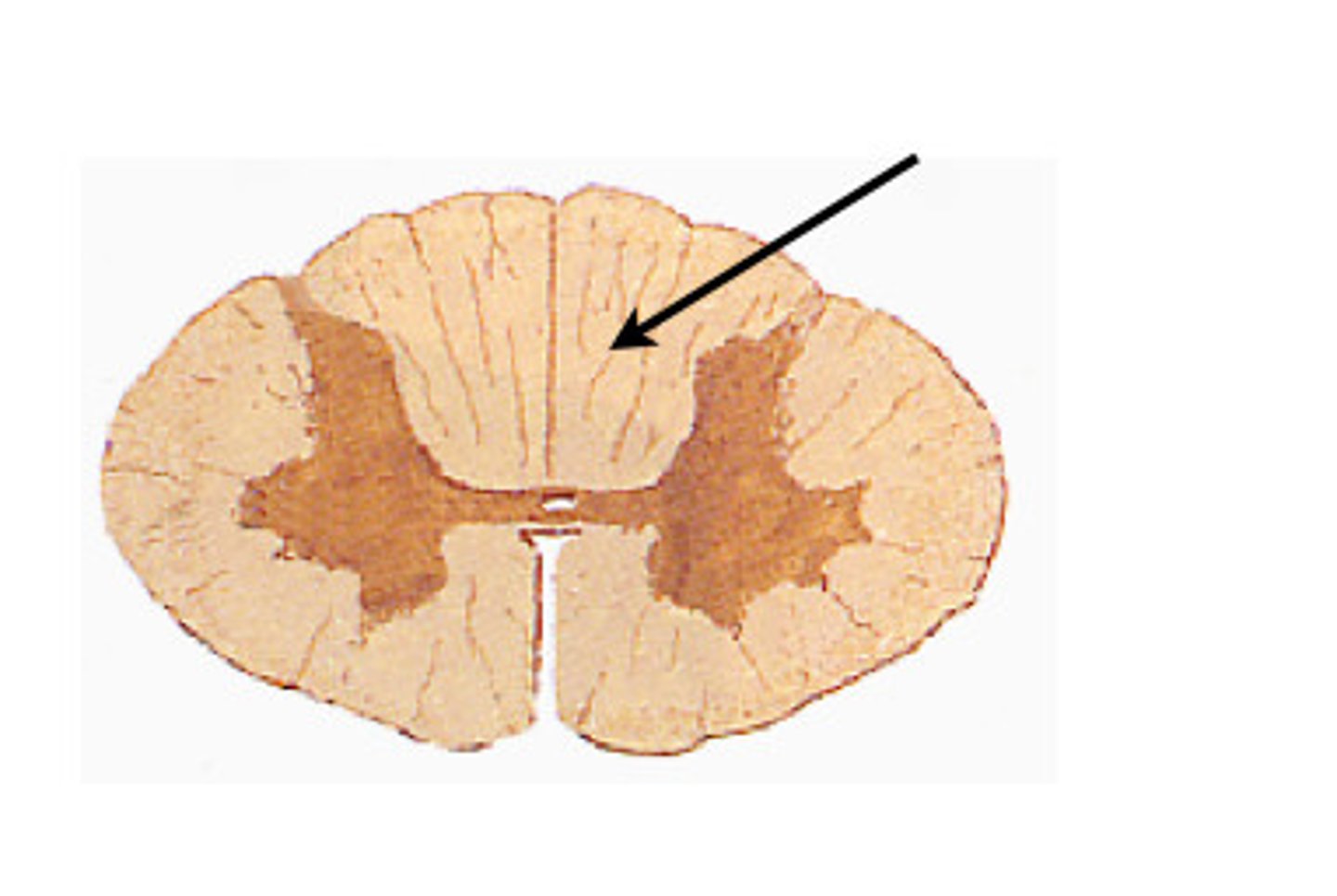 <p>make up the dorsal white column</p><p>gracilis = sacral and lumbar</p><p>cuneatus = thoracic and cervical</p>