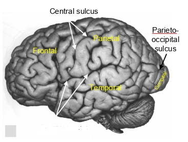 <p>which sulcus is this?</p>