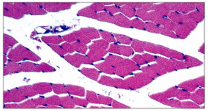 <p>Which type of skeletal muscle fibers is:</p><ul><li><p>Are slow to contract, slow to fatigue</p></li><li><p>Have small diameter, more mitochondria</p></li><li><p>Have high oxygen (blood) supply</p></li><li><p>Contain myoglobin (binds oxygen)</p></li><li><p>Dark (chicken legs)</p></li></ul><p></p>