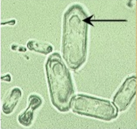 <p>Calcium oxalate monohydrate</p>