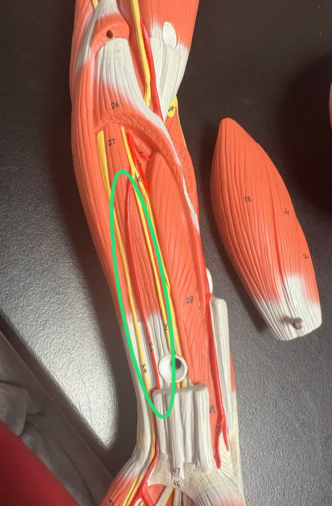 <p>runs down forearm towards pinky finger </p>