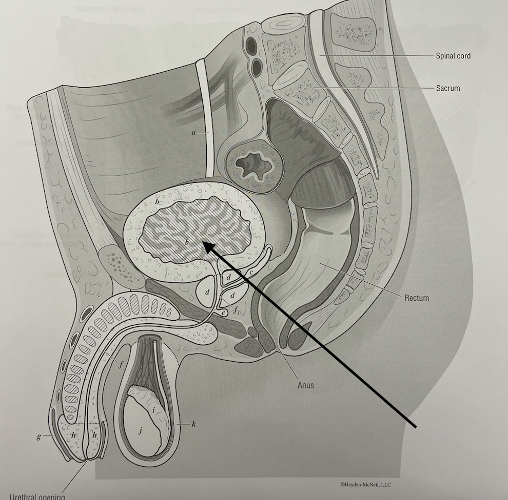 <p>what structure is this</p>