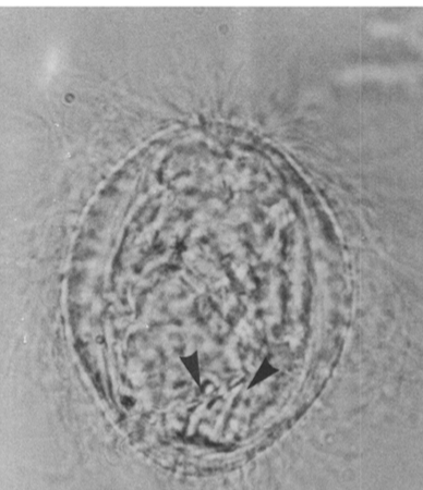 <ul><li><p>Sparganum larval stage, solid-body with slit-like mouthparts​</p></li><li><p>Found in muscle of intermediate host</p></li></ul><p></p>