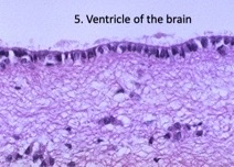 What type of glial cells?