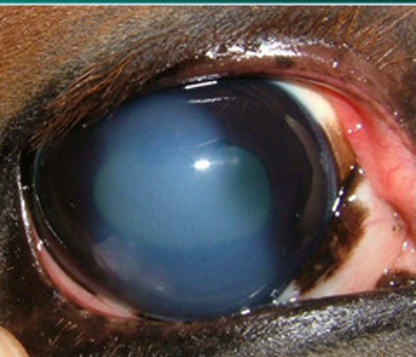 <p>What is the problem with immune mediated endothelitis? What can it progress to?</p>